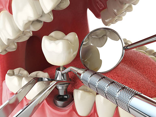 Best Emergency Dental Surgery in Chaparral, NM